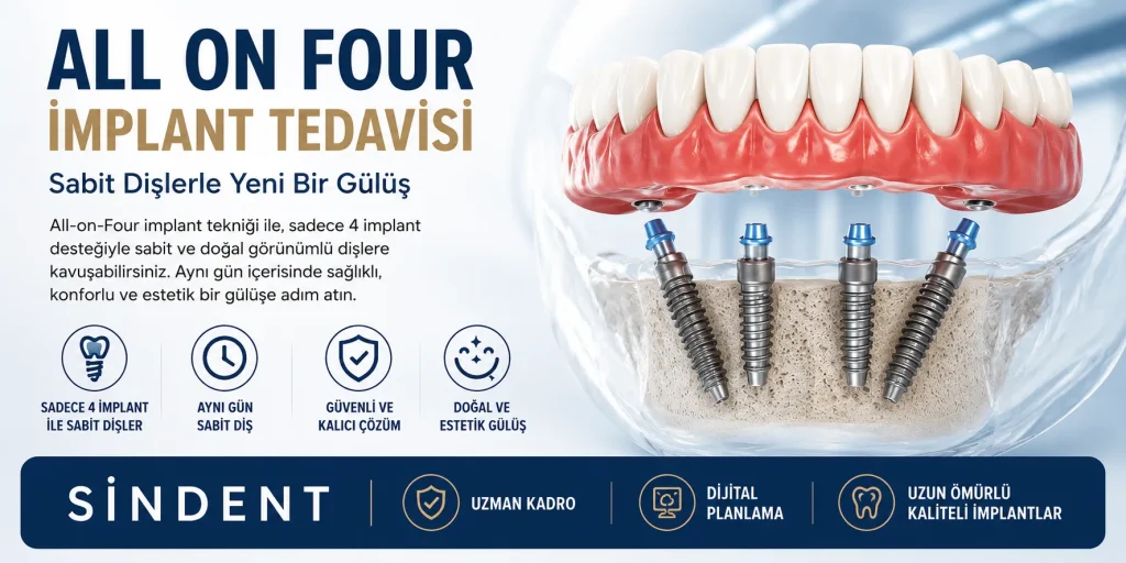 All on four implant tedavisi